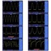 Kép 8/11 - FG-200 DDS funkciójelgenerátor, frekvenciaszámláló 0,01 Hz - 500 KHz jelforrás modul - Antenna nélkül