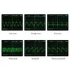Kép 10/14 - 1Hz-500kHz FG-100 DDS Funkciógenerátor Szinusz Háromszög Négyszög Fűrészfog EKG Zaj Frekvenciamérő Jelforrás Modul