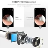 Kép 3/7 - 1080P fülzsír eltávolító otoszkóp, 360°-os széles látószögű kamera, vezeték nélküli fültisztító - fekete