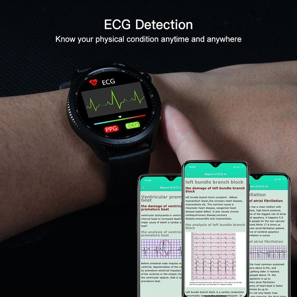 E102 okosóra pulzusszám vérnyomás EKG monitorral IP68 Vízálló - Fekete