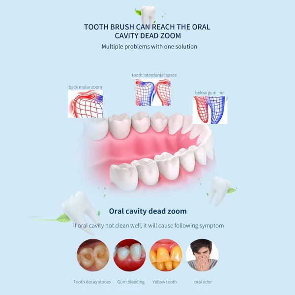 Sonic Vibration Light Guide Dental Scaler Elektromos vibrációs fogtisztító szájápoló készülék - Fekete