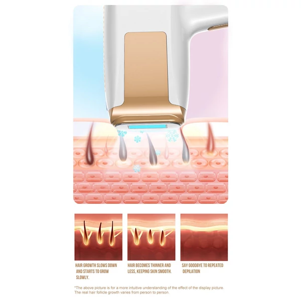 Tartós IPL teljes test szőrtelenítő eszköz, háztartási erős impulzusú zafír fagypont védőszemüveggel és borotvával - Fehér